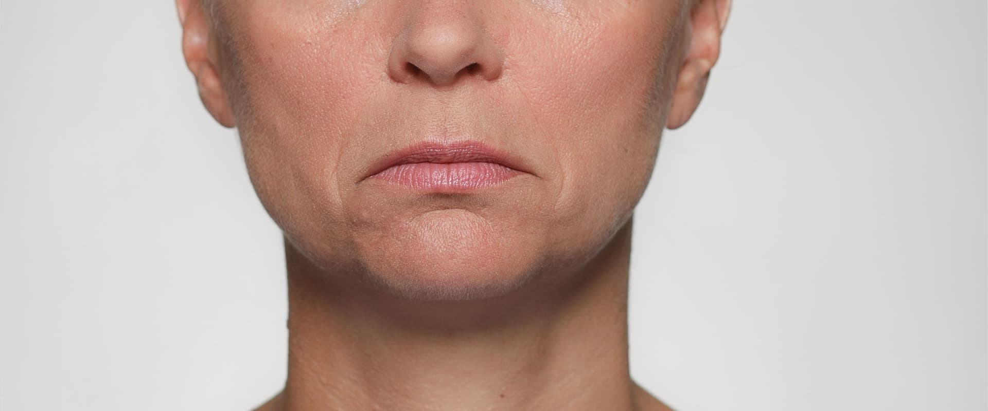 Heruntergezogene Mundwinkel