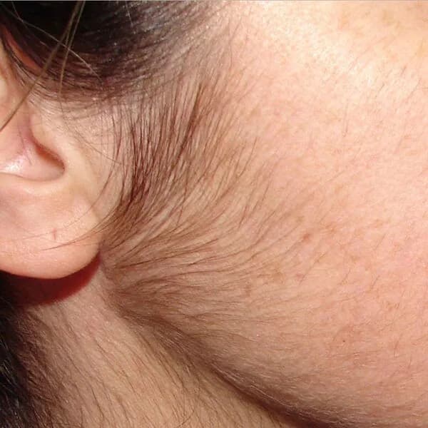 Psychische Belastung