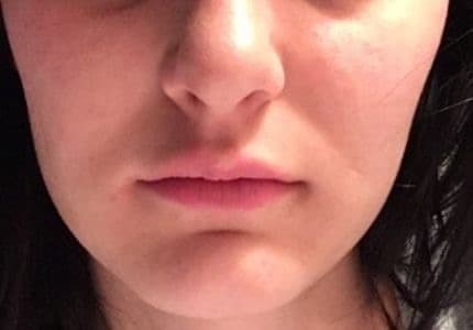 Unharmonisches Profil