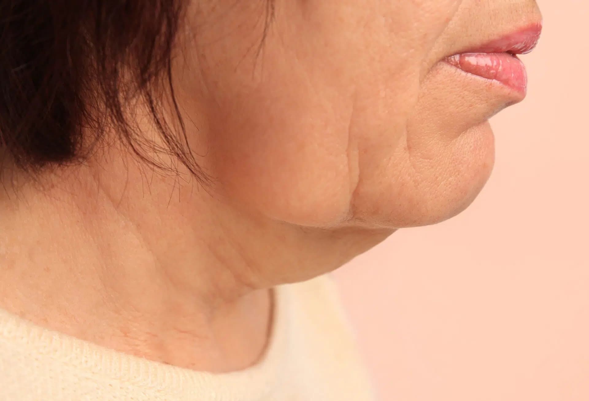 Unscharfe Kieferlinie