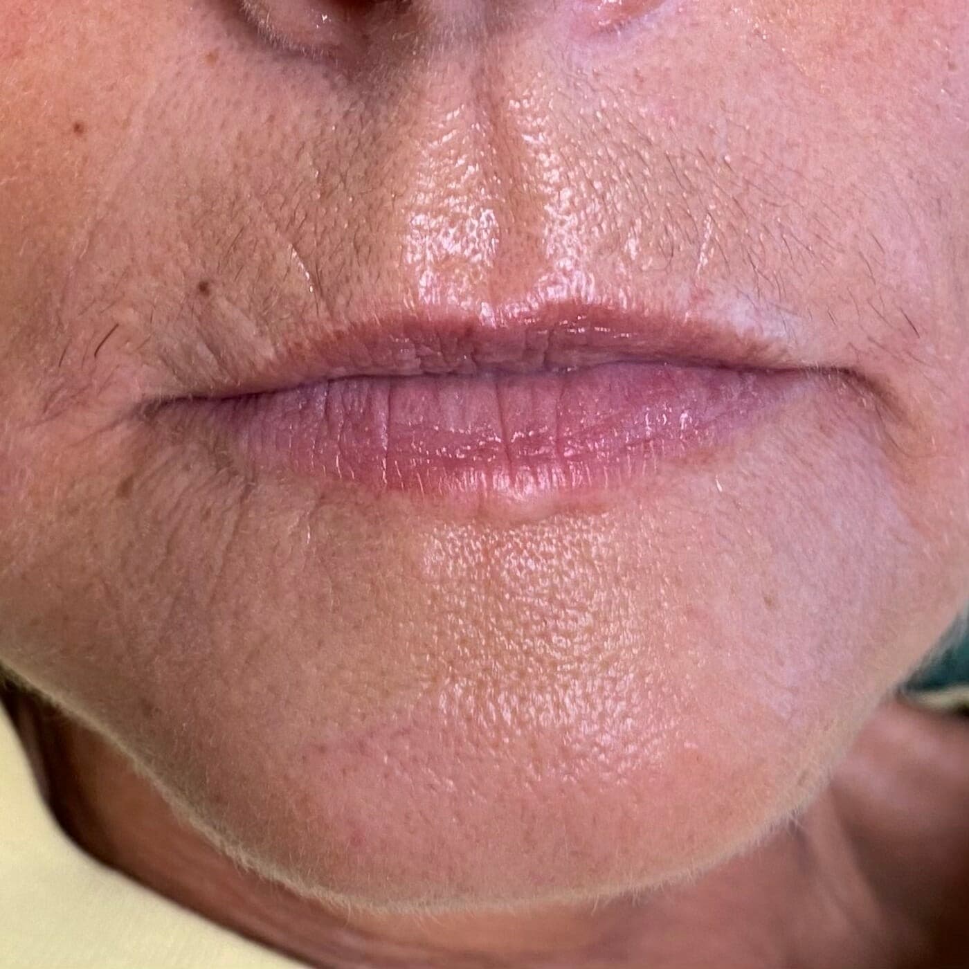 Unscharfe Lippenkontur